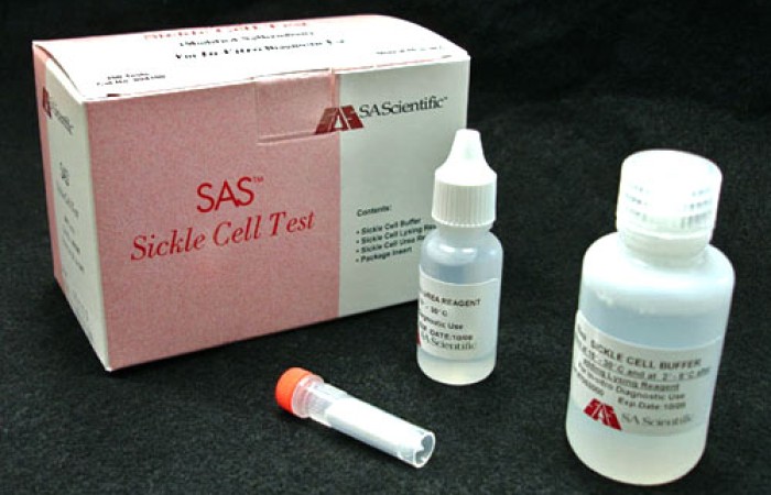 Sickle Cell